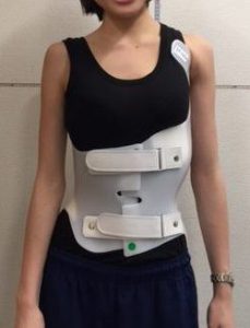 GBWFRONTnbsp| シュロスベストプラクティスジャパン | 最新の側弯症のシュロス式運動療法と装具をドイツから