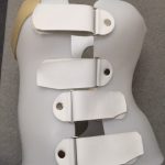 nbsp| シュロスベストプラクティスジャパン | 最新の側弯症のシュロス式運動療法と装具をドイツから