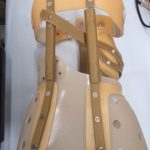 nbsp| シュロスベストプラクティスジャパン | 最新の側弯症のシュロス式運動療法と装具をドイツから
